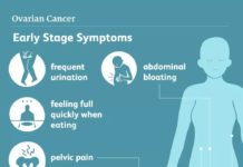 Women who use low-dose aspirin had a 23% lower risk of developing ovarian cancer