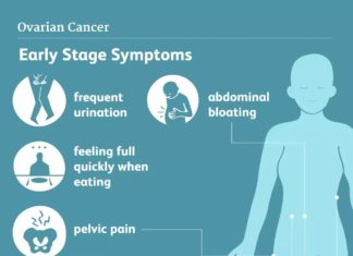 Women who use low-dose aspirin had a 23% lower risk of developing ovarian cancer