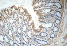 Protein investigated for its possible role in cancer turned out to be a powerful regulator of metabolism