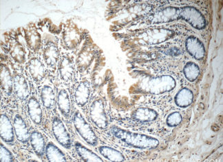 Protein investigated for its possible role in cancer turned out to be a powerful regulator of metabolism