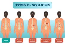 Body’s inability to fully utilize mineral manganese might be to blame for some cases of severe scoliosis
