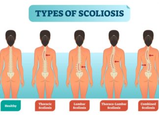 Body’s inability to fully utilize mineral manganese might be to blame for some cases of severe scoliosis