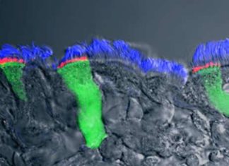 Study shows that two cystic fibrosis (CF) drugs aimed at correcting the defected CFTR protein