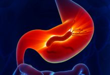 Viruses in blood can lead to digestive problems