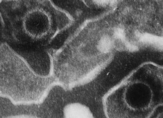 A world-first clinical trial of a new cellular immunotherapy for multiple sclerosis (MS) has improved symptoms and quality of life for the majority of patients