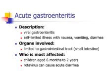 Commonly used probiotic is not effective in improving symptoms in young patients with gastroenteritis
