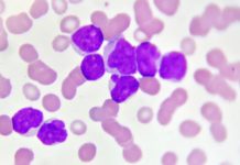 Acute myeloid leukemia (AML) – 91 percent response rate to the combination of venetoclax with azacitidine