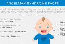 Angelman syndrome is a genetic disease with no cure – scientists found evidence that genetic therapy may prevent the enhanced seizure susceptibility