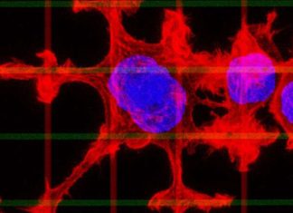 Biomedical engineers shows how they stopped cancer cells from moving and spreading