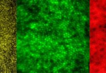 By combining two imaging modalities researchers can see live neurons, epithelial cells, and blood vessels deep in the eye’s light-sensing retina