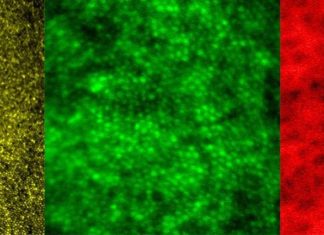 By combining two imaging modalities researchers can see live neurons, epithelial cells, and blood vessels deep in the eye’s light-sensing retina