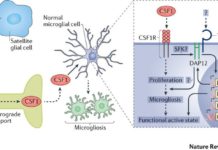Brain tumors : prevented cognitive decline by temporarily shutting down immune response
