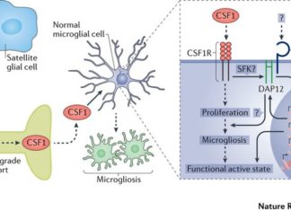 Brain tumors : prevented cognitive decline by temporarily shutting down immune response