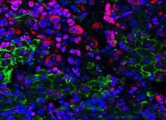 In chemotherapy, cytostatics – substances halting cell proliferation – prevent cancer cells from growing and induce cellular death