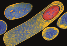 Scientists identified the mechanisms by which the bacterial pathogen Clostridium difficile kills intestinal epithelial cells (IECs)