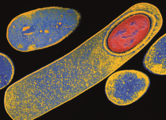 Scientists identified the mechanisms by which the bacterial pathogen Clostridium difficile kills intestinal epithelial cells (IECs)