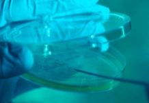 Diabetic foot ulcers can take up to 150 days to heal. A biomedical engineering team wants to reduce it to 21 days