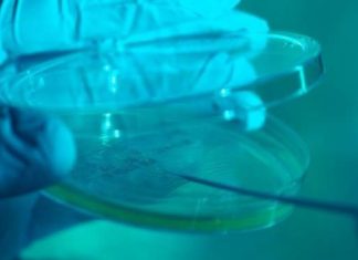 Diabetic foot ulcers can take up to 150 days to heal. A biomedical engineering team wants to reduce it to 21 days