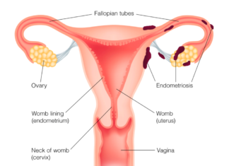 Researchers at Northwestern Medicine have taken the first step in bioengineering the human uterus to treat endometriosis, uterine-factor infertility and endometrial cancer