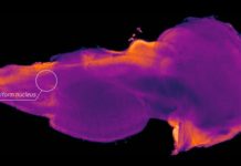 Researchers have identified a hidden region in the human brain – may help advance treatments for Parkinson’s disease