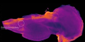 Researchers have identified a hidden region in the human brain – may help advance treatments for Parkinson’s disease