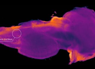 Researchers have identified a hidden region in the human brain – may help advance treatments for Parkinson’s disease