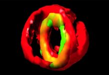 First look at the essential protein molecule responsible for prompting cell division in Staphylococcus aureus