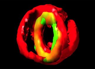 First look at the essential protein molecule responsible for prompting cell division in Staphylococcus aureus
