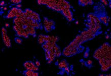 Problem pregnancies : Reasearchers created the first cellular atlas of the early human placenta