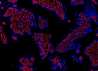 Problem pregnancies : Reasearchers created the first cellular atlas of the early human placenta
