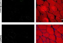 Klotho – ‘Longevity protein’ rejuvenates muscle healing