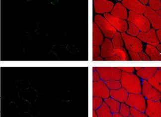 Klotho – ‘Longevity protein’ rejuvenates muscle healing