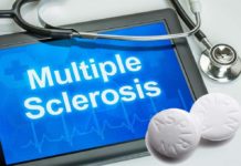 Low-dose aspirin may help fight MS
