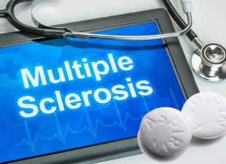 Low-dose aspirin may help fight MS