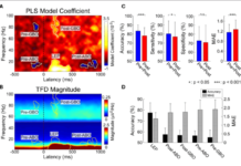 Researchers developed an electroencephalogram test to measure pain objectively