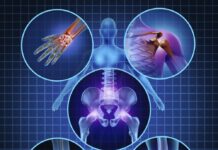 Researchers explain the patchy nature of joint inflammation in human arthritis