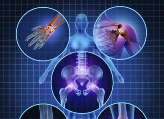 Researchers explain the patchy nature of joint inflammation in human arthritis