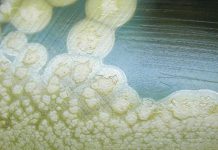 Researchers have identified a compound that strongly inhibits botulinum neurotoxin