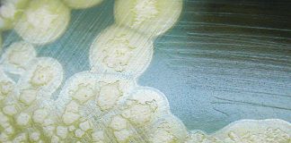 Researchers have identified a compound that strongly inhibits botulinum neurotoxin