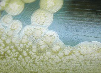 Researchers have identified a compound that strongly inhibits botulinum neurotoxin