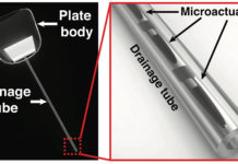 Researchers have invented a new smart drainage device to help patients with glaucoma