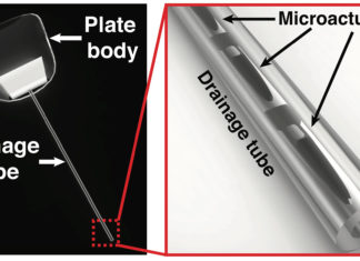 Researchers have invented a new smart drainage device to help patients with glaucoma