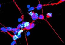 Researchers identified the cascade of cell death events leading to the physical and intellectual degeneration associated with Parkinson’s disease