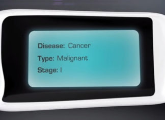 Israeli Scientist Developed Breath Test Device That Detects Diseases