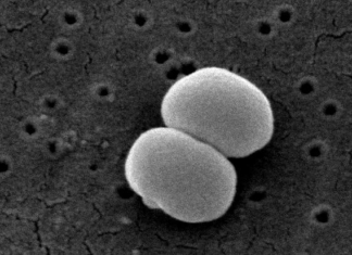 Staphylococcus epidermidis, is a major cause of life-threatening infections after surgery