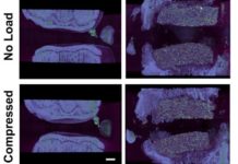 For the first time, bioengineered spinal discs were successfully implanted and provided long-term function for tissue-engineered disc replacement