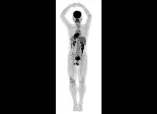 World’s first medical imaging scanner that can capture a 3-D picture of the whole human body at once