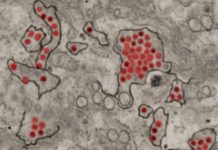 Zika virus may hijack the route by which acquired immunity is transferred from mother to fetus