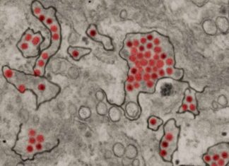 Zika virus may hijack the route by which acquired immunity is transferred from mother to fetus