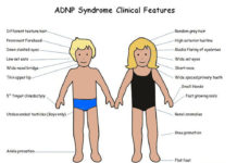 A new Tel Aviv University study finds that the drug candidate CP201, also known as NAP, may improve vocal communication abilities that are underdeveloped in ADNP patients